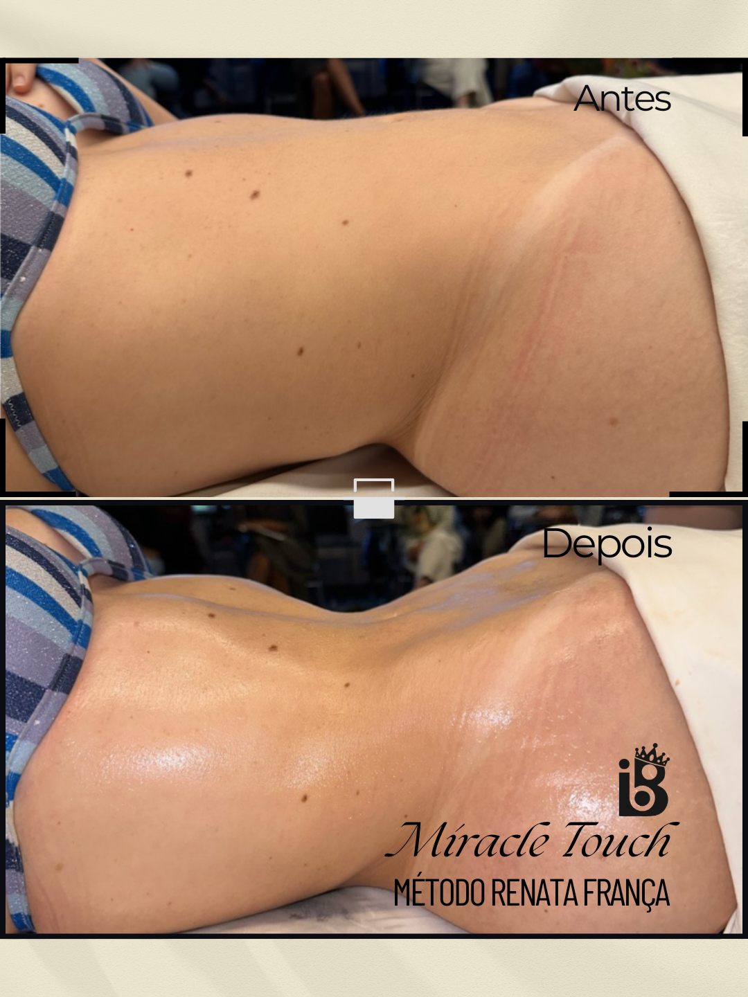 Resultado Miracle Touch