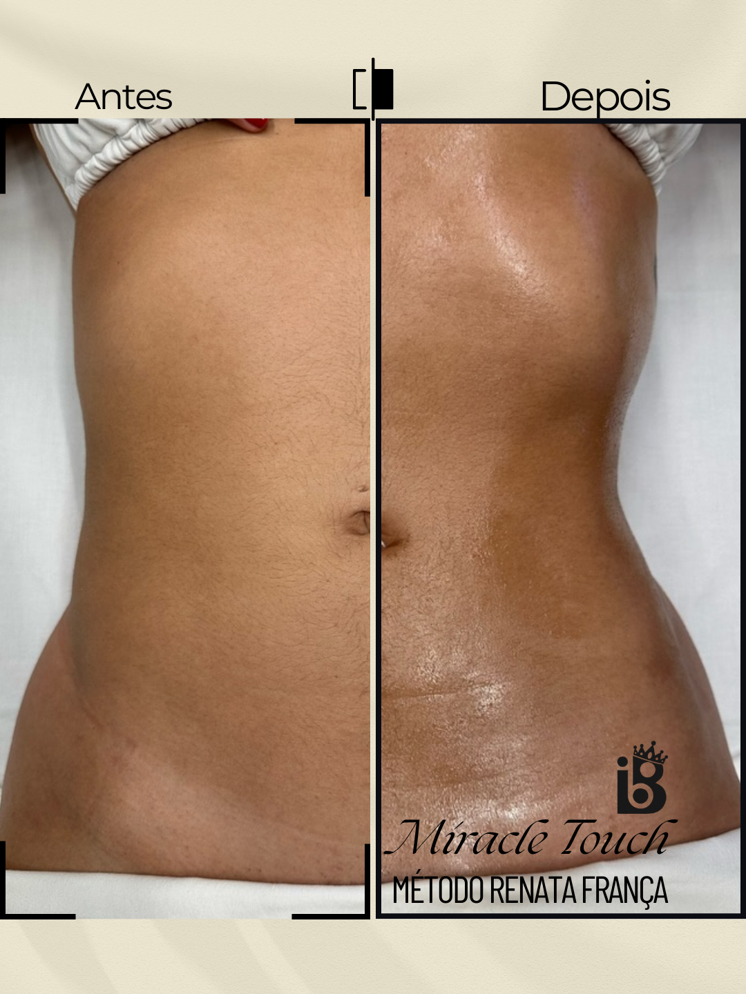 Resultado Miracle Touch