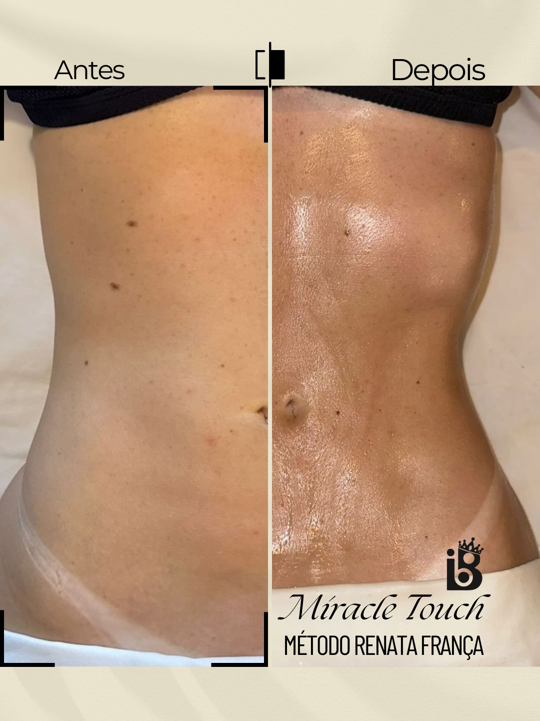 Resultado Miracle Touch