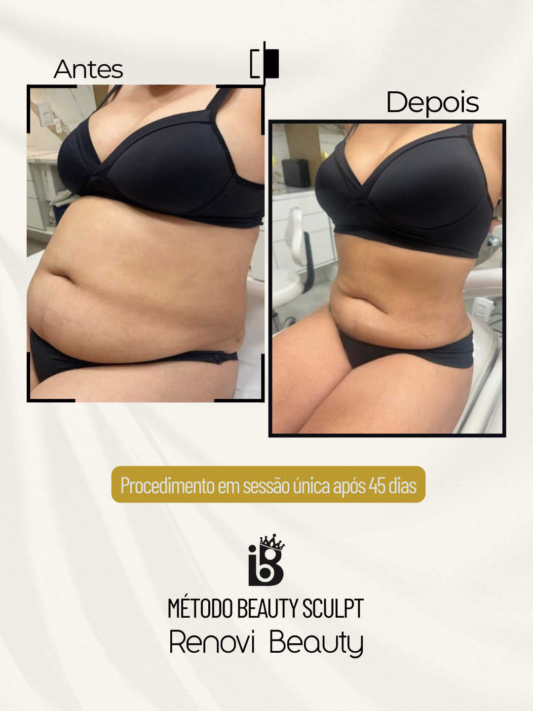 Resultados Beauty Sculpt