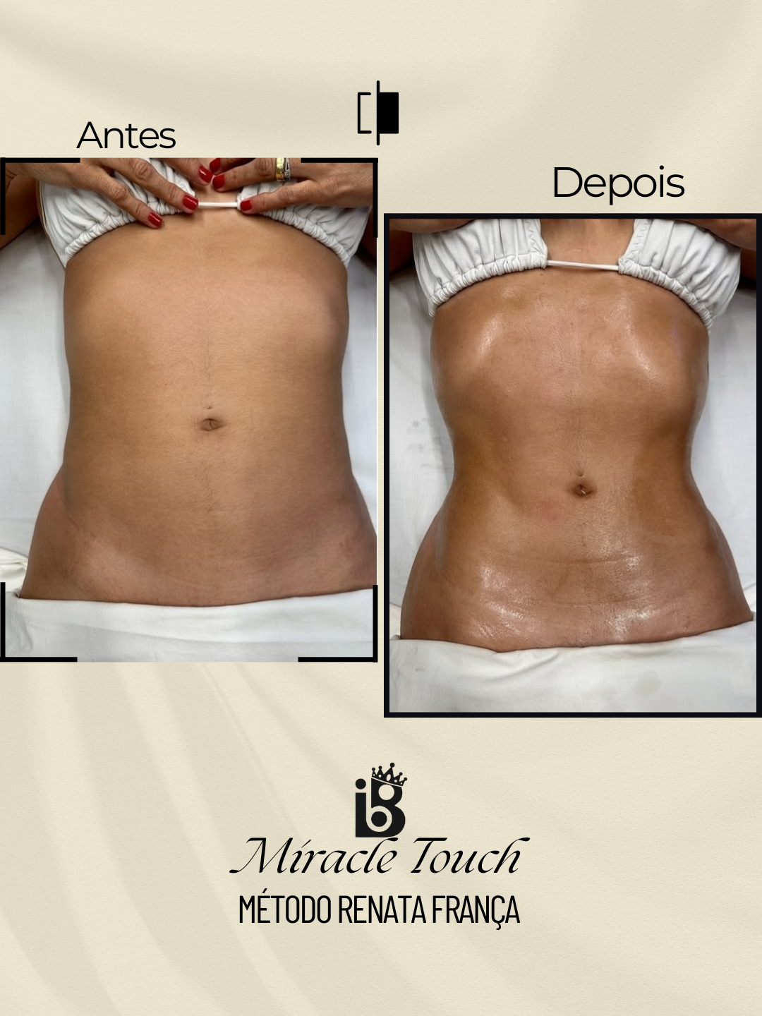 Resultado Miracle Touch