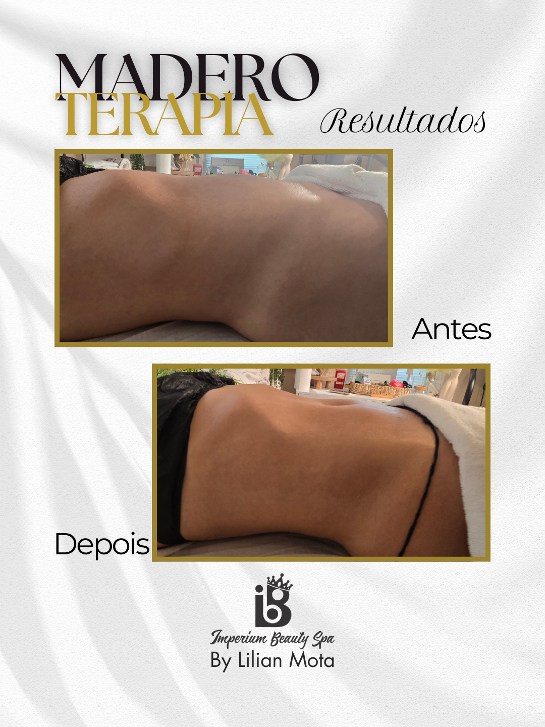 Resultado Maderoterapia