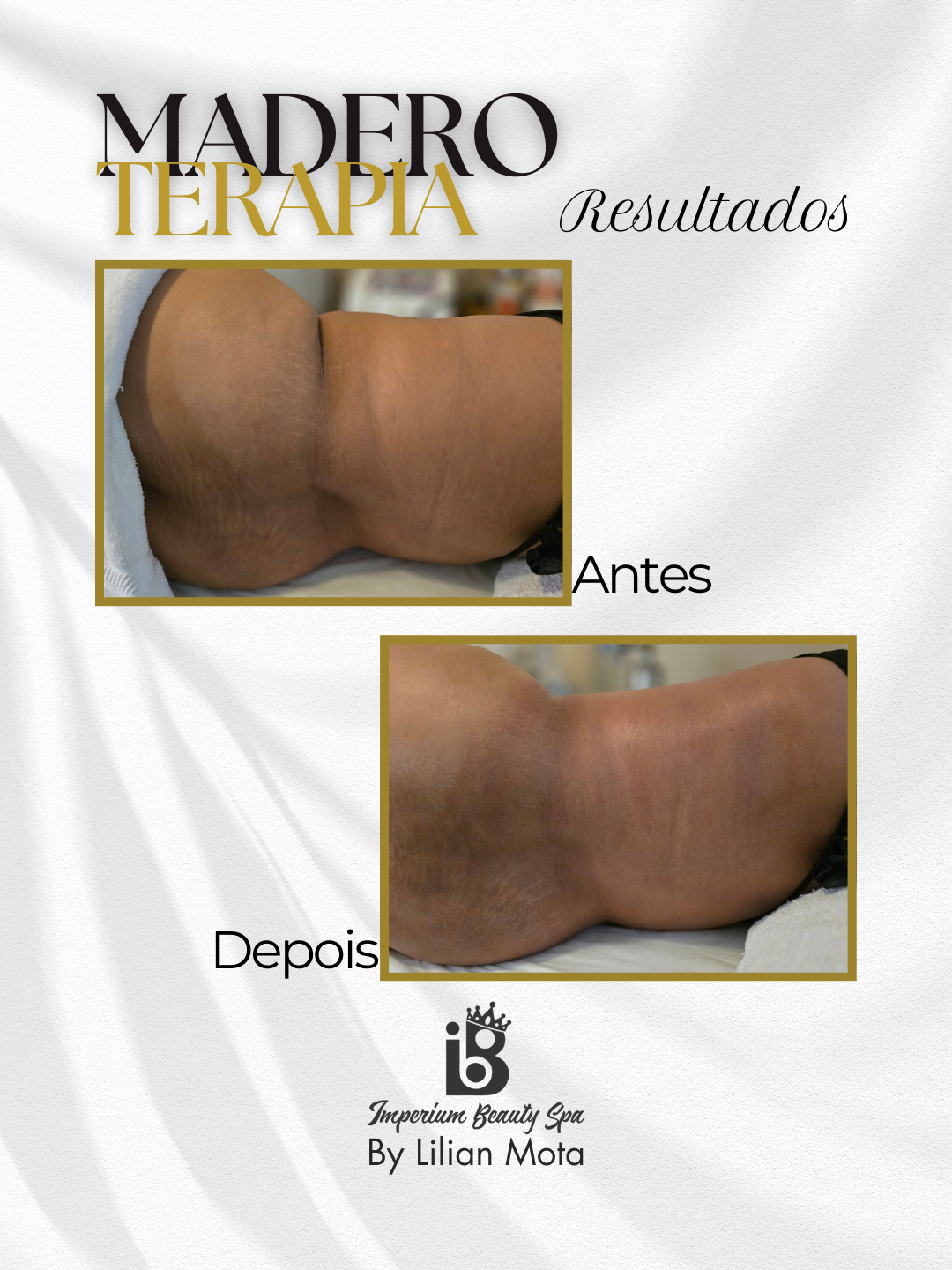 Resultado Maderoterapia