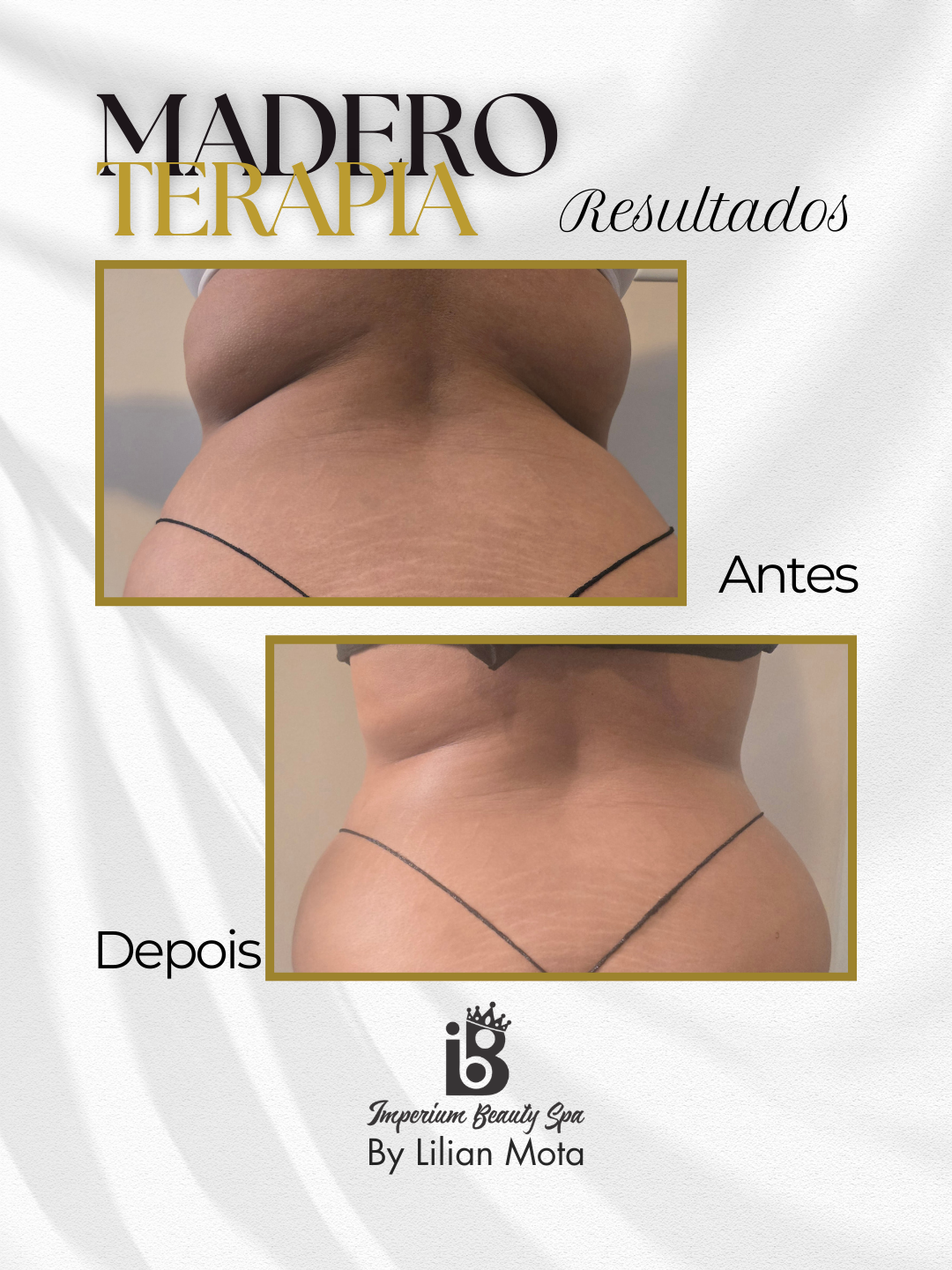 Resultado Maderoterapia