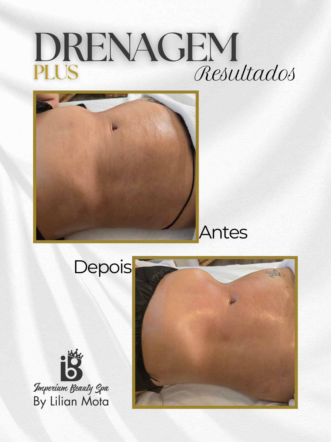 Resultado Drenagem Plus