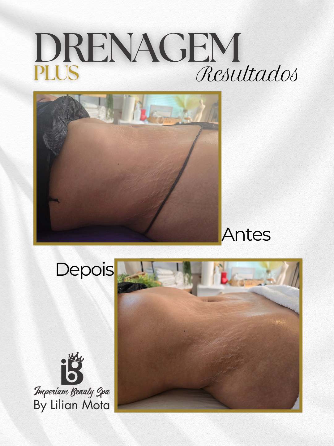 Resultado Drenagem Plus