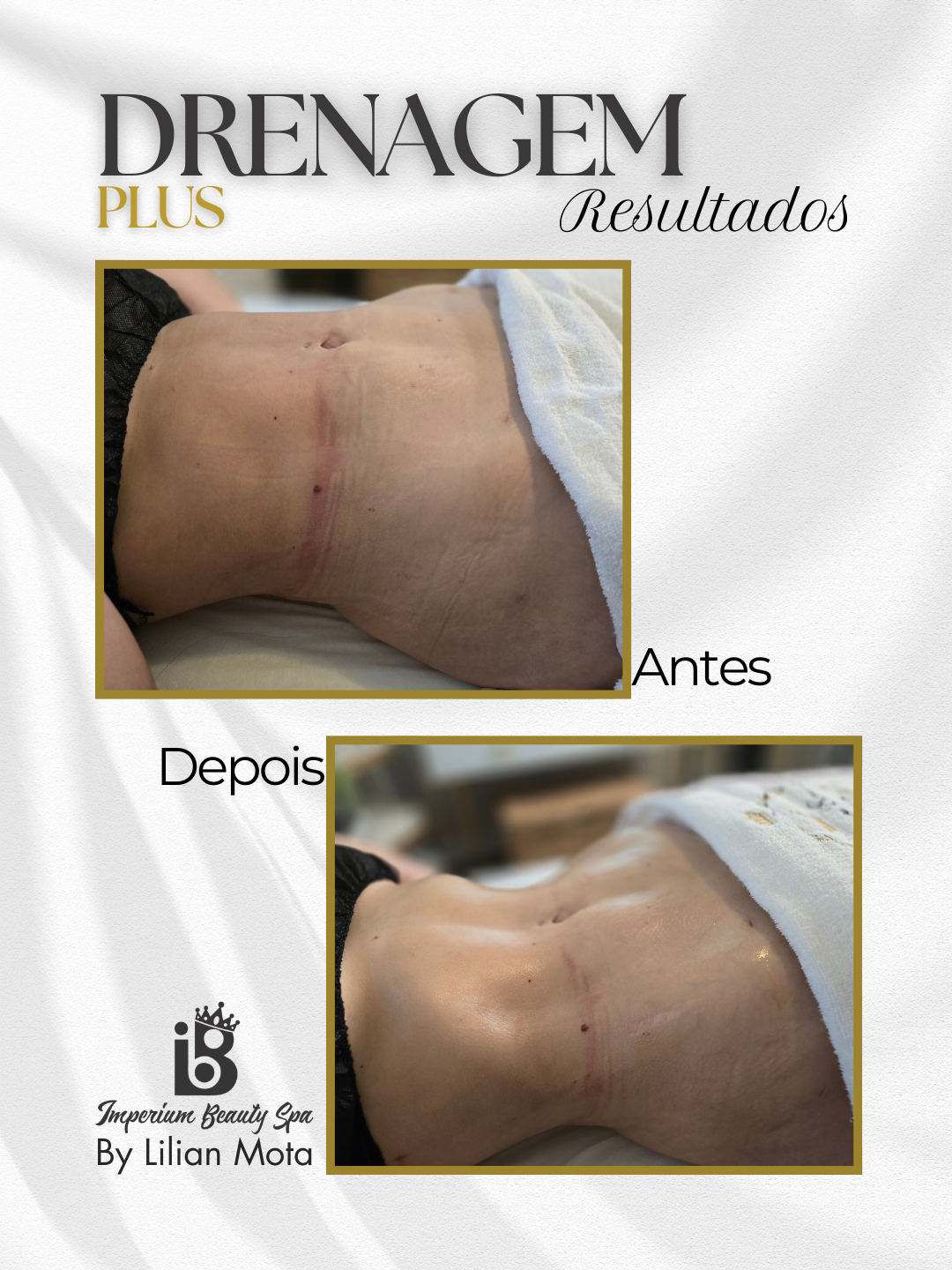 Resultado Drenagem Plus